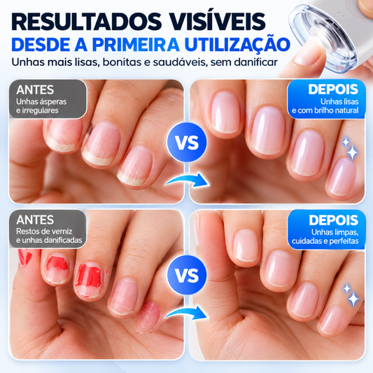 Lixador de unhas automático universal para adultos e crianças