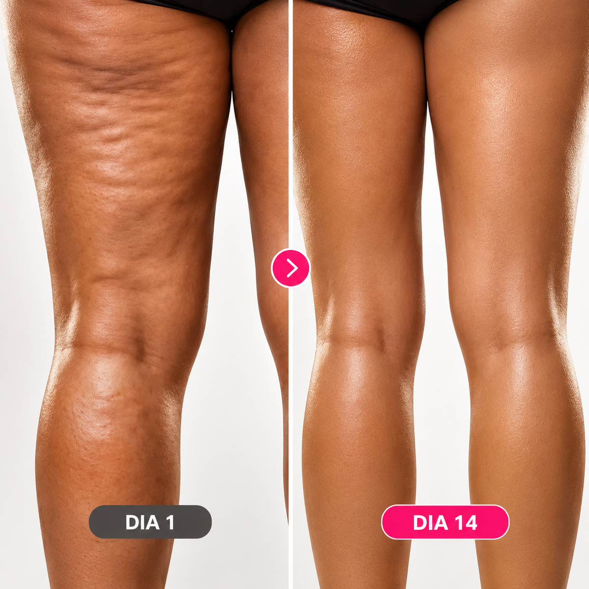 SculptPro™ – Dispositivo de Massagem Corporal