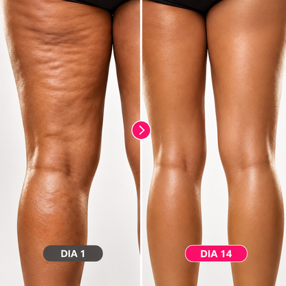 SculptPro™ – Dispositivo de Massagem Corporal